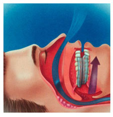 Oral appliance therapy